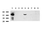 FTCD Antibody in Western Blot (WB)