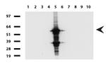 FTCD Antibody in Western Blot (WB)