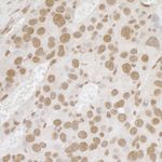 FUS Antibody in Immunohistochemistry (IHC)