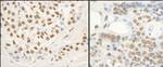 FUS Antibody in Immunohistochemistry (IHC)