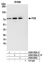 FUS Antibody in Western Blot (WB)