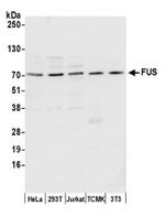 FUS Antibody in Western Blot (WB)