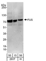 FUS Antibody in Western Blot (WB)