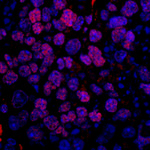 FUSIP1 Antibody in Immunohistochemistry (IHC)