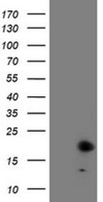 FXN Antibody in Western Blot (WB)