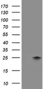 FXN Antibody in Western Blot (WB)