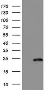 FXN Antibody in Western Blot (WB)