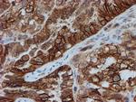 FXYD3 Antibody in Immunohistochemistry (Paraffin) (IHC (P))