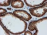 FXYD3 Antibody in Immunohistochemistry (Paraffin) (IHC (P))