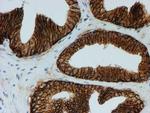 FXYD3 Antibody in Immunohistochemistry (Paraffin) (IHC (P))