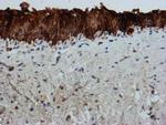 FXYD3 Antibody in Immunohistochemistry (Paraffin) (IHC (P))