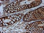 FXYD3 Antibody in Immunohistochemistry (Paraffin) (IHC (P))