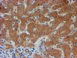 FXYD3 Antibody in Immunohistochemistry (Paraffin) (IHC (P))