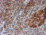 FXYD3 Antibody in Immunohistochemistry (Paraffin) (IHC (P))