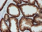 FXYD3 Antibody in Immunohistochemistry (Paraffin) (IHC (P))