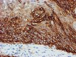 FXYD3 Antibody in Immunohistochemistry (Paraffin) (IHC (P))