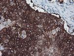 FXYD3 Antibody in Immunohistochemistry (Paraffin) (IHC (P))