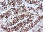 FXYD3 Antibody in Immunohistochemistry (Paraffin) (IHC (P))