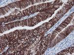 FXYD3 Antibody in Immunohistochemistry (Paraffin) (IHC (P))