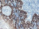 FXYD3 Antibody in Immunohistochemistry (Paraffin) (IHC (P))