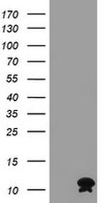 FXYD3 Antibody in Western Blot (WB)