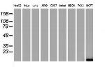 FXYD3 Antibody in Western Blot (WB)