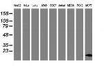 FXYD3 Antibody in Western Blot (WB)