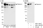 Filamin A Antibody in Western Blot (WB)