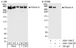 Filamin A Antibody in Western Blot (WB)