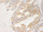 Filamin B Antibody in Immunohistochemistry (IHC)