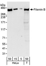 Filamin B Antibody in Western Blot (WB)