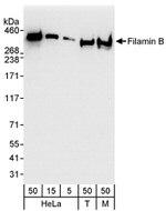 Filamin B Antibody in Western Blot (WB)