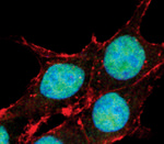 FOXO3A Antibody in Immunocytochemistry (ICC/IF)