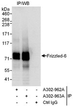 Frizzled-6 Antibody in Immunoprecipitation (IP)