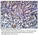 G0/G1 switch 2 Antibody in Immunohistochemistry (IHC)