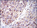 G6PD Antibody in Immunohistochemistry (Paraffin) (IHC (P))