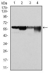 G6PD Antibody in Western Blot (WB)