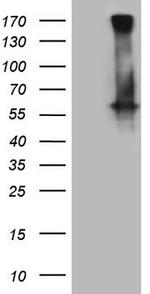 GABRA5 Antibody in Western Blot (WB)