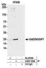GADD45GIP1/CRIF1 Antibody in Western Blot (WB)