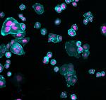 Human IgG (H+L) Cross-Adsorbed Secondary Antibody in Immunocytochemistry (ICC/IF)