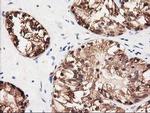 GALE Antibody in Immunohistochemistry (Paraffin) (IHC (P))