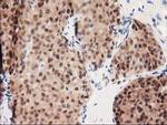 GALE Antibody in Immunohistochemistry (Paraffin) (IHC (P))