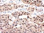 GALE Antibody in Immunohistochemistry (Paraffin) (IHC (P))