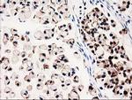 GALE Antibody in Immunohistochemistry (Paraffin) (IHC (P))