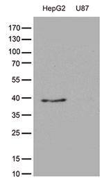 GALM Antibody in Western Blot (WB)