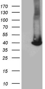 GALM Antibody in Western Blot (WB)