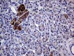 GALNT10 Antibody in Immunohistochemistry (Paraffin) (IHC (P))