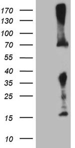 GALNT10 Antibody in Western Blot (WB)