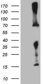 GALNT10 Antibody in Western Blot (WB)