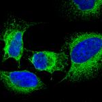 Mouse IgG (H+L) Highly Cross-Adsorbed Secondary Antibody in Immunocytochemistry (ICC/IF)